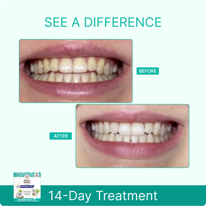 14 Day Whitening Strips