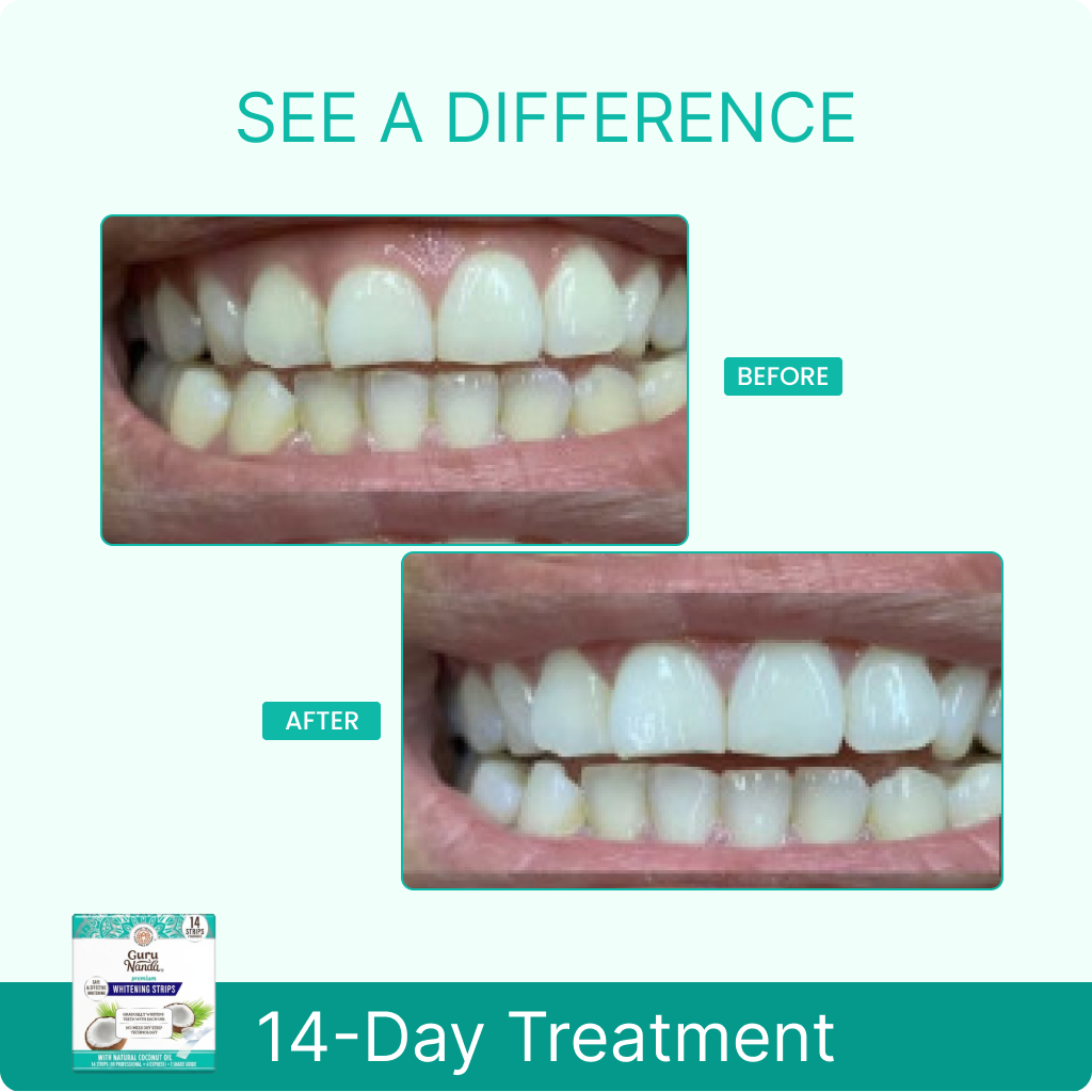 14 Day Whitening Strips