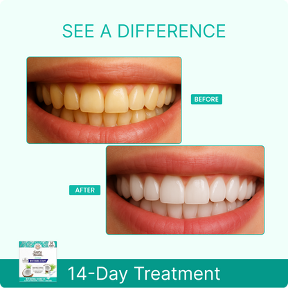 14 Day Whitening Strips